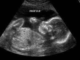 Taylor  Baby Gender Reveal
