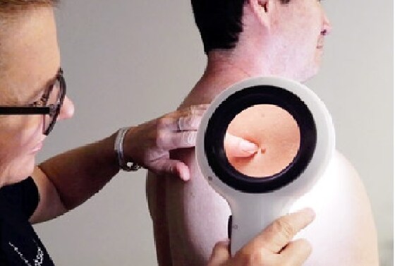 Free Skin Checks - (for the first 20 responders)