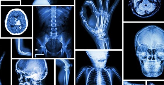 Wellbeing Group - Radiology